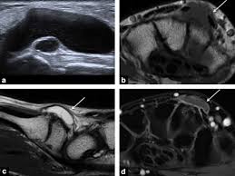 Trade shows by industry trade shows by month trade shows by location trade shows by organizer. Tumors And Pseudotumors Of The Hand The Role Of Imaging Sciencedirect