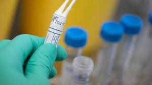 The world health organization (who) named it lambda variant on 14 june 2021. Covid Cresce La Variante Delta Ma Spunta Anche La Lambda Del Peru Telerama News