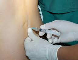 What Is An Epidural American Pregnancy Association
