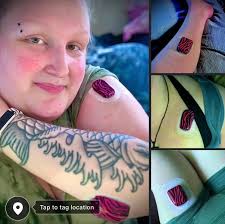 Diabetes Omnipod/Dexcom/Libre Water Marbling