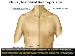 * listen for a lub dub sound which equals one heartbeat, an open and close. Three Types Of Cardiac Apical Impulse An Illustration Dr S Venkatesan Md