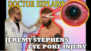 Cheick kongo and todd duffee vs. What Happened To Jeremy Stephens Eye Corneal Abrasion Ufc Mexico Youtube