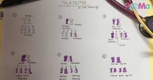 Sesetengah pesakit talasemia dengan malaria, kerana wabak sering dicatatkan di rantau ini. Pilih Pasangan Dengan Bijak Elak Anak Hidap Talasemia Doktor Kongsi Tentang Tanda Tanda Talasemia Pa Ma