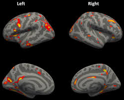 However, they tend to play, learn, speak, and. Structural Brain Abnormalities Of Attention Deficit Hyperactivity Disorder With Oppositional Defiant Disorder Biological Psychiatry