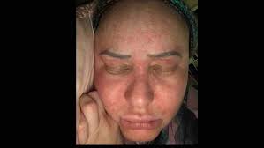 Fundraiser for Emily Cruz by Nina Venter : Emily's Breast Cancer Journey