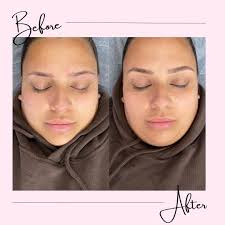 Microblading/ ombré brows/ combo brows models needed for social media  content. Performed by experienced brow professional, using only premium ink  that heals true to colour ❤️ Cost: free 💕 Location: Beacon Hill,