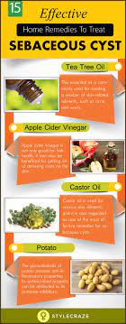 When Sebaceous Cysts Develop On The Body They Can Turn Out To Be The Absolute Source Of Annoyance Are You Suffe Health Remedies Herbal Remedies Healthy Fiber