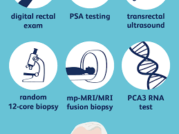 Sexual dysfunction can be an early sign of prostate cancer in men. How Prostate Cancer Is Diagnosed