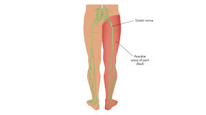 As stated before, sciatica pain can cause a lot of pain when you are sitting down. Yoga And Sciatica Do S And Don Ts To Consider