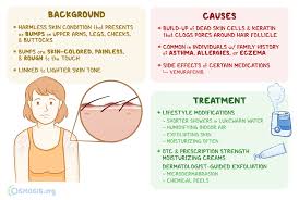 Image result for Keratosis pilaris