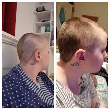 Does shaving unwanted body hair make it grow back thicker and darker? Hair Growth Left Is A Month Ago Freshly Shaved Head Right Is Today I Ve Also Shaved My Head Twice In That Month Until I Was Feeling More Comfortable With My Spots