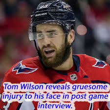 Tom Wilson reveals the gruesome damage to his face in post game interview.  Videos and more linked in the comments below.