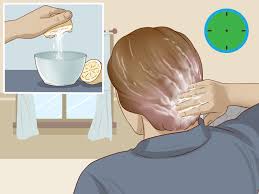 A mixture of dandruff shampoo and baking soda should be strong enough to help lift your hair dye, without drying out your strands. How To Remove Permanent Hair Dye 12 Steps With Pictures