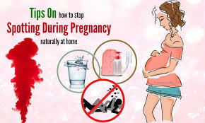 It is considered spotting when you notice a few drops. 18 Tips On How To Stop Spotting During Pregnancy At Home