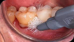 5 Routine Things We Do in the Dental Profession