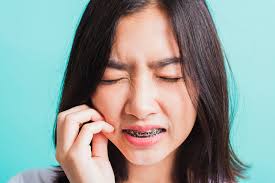 For pain and headaches , we may recommend taking a mild painkiller like tylenol. 7 Ways To Reduce Braces Pain Ismiles Kids Dentistry Orthodontics