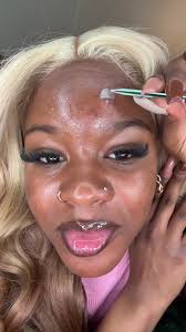 Best Pimple Patches for Acne Treatment