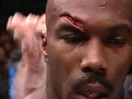 What the nastiest UFC moment? : r/ufc