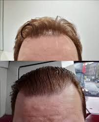 It can't substitute for a sudsy wet wash, but it can help dry out oils and give your hair a cleaner appearance. Greasy Hair Help Hair