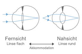We did not find results for: Altersweitsichtigkeit Presbyopie
