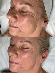 Some times all you need is a DMK...