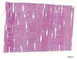 Image result for Dalbergia acutifoliolata