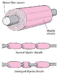 It can lead to weakness and paralysis that may last for months or years. Guillain Barre Syndrome Gbs Brain Spinal Cord And Nerve Disorders Msd Manual Consumer Version