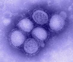 Viral pneumonia is generally not very serious to healthy adults, but it can be deadly for very young and very old patients as well as those with impaired. Avian Influenza Virus In North American Migratory Birds Institute Of The Environment And Sustainability At Ucla