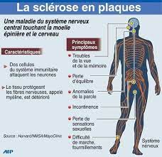 La sep est une affection du systme nerveux central (cerveau, moelle. Sclerose En Plaques Antilles Guyane Delegation Afsep Home Facebook