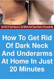 How To Get Rid Of Dark Neck And Underarms At Home In Just 20 Minutes Dark Patches Usually Appear On The Dark Spots On Skin Dark Underarms Dark Patches On Skin