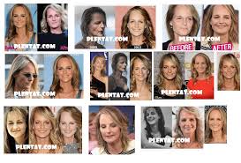 The former kate & leopold star was reported to make a big mistake by having too much plastic surgery including botox, eyelid surgery (blepharoplasty), nose job … Helen Hunt Plastic Surgery Before And After American Actress Director Screenwriter