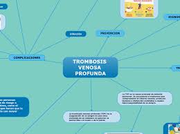 La trombosis venosa profunda es la coagulación de la sangre en una vena profunda de un miembro (en general, la pantorrilla o el muslo) o de la pelvis. Trombosis Venosa Profunda Carte Mentale