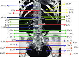 The Prevalence And Distribution Of The Atherosclerotic Plaques In Download Scientific Diagram