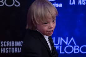 El sexo es como jugar al bridge. El Es Mathias El Actor Con Sindrome De Down Que Esta Cambiando Modelos En Cuna De Lobos Video 24 Horas