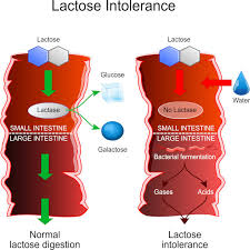 Ecco una lista dei 10 che sarebbe proprio il caso di evitare: Intolleranza Al Lattosio Sintomi Dieta E Rimedi Biosalts