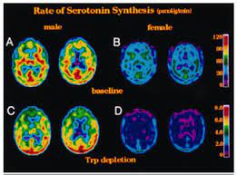 There is a family first payment program that offers discounts. How Much Does A Brain Scan Cost At The Amen Clinic Mri Scan Machine