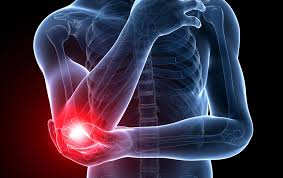 The condition causes pain at the point where the tendon attaches to the epicondyle. Everything You Need To Know About Tennis Elbow By Osd Medium