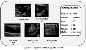 Image result for Biophysical Profile