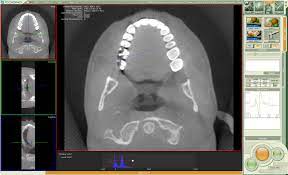 The features of these dicom viewer software is that they are suited for patient cds/dvds. Dicom Viewer For Mac Free Download Peatix