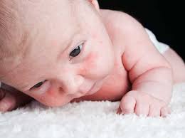 Your baby's sensitive skin needs special care every day. Mgzyrbehk2x7qm