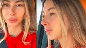 Şeyma subaşı haberleri, güncel son dakika gelişmeleri ve bugün yer alan son durum bilgileri için tıklayın! Estetik Operasyon Geciren Seyma Subasi Nin Burnu Mu Dustu