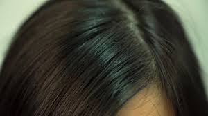 Buy black hair dandruff to breathe life in damaged hair and save yourself from the agony of dandruff or hair loss. Dandruff Black Hair Stock Video Footage 4k And Hd Video Clips Shutterstock