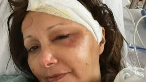 Fundraiser for Angelica Chacon by Leonor Chacon : Recuperación: Angelica  Carolina