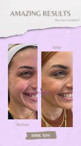 Green Dreams Canovanas