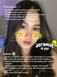 Penyebab Jerawat di Wajah dan Solusinya yang Ampuh