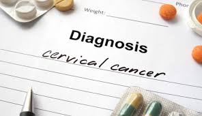 Ignoring symptoms may allow the cancer to grow to a more advanced stage and lower your chance for successful treatment. 5 Cervical Cancer Myths Md Anderson Cancer Center