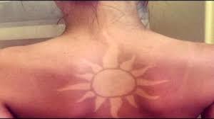 Christian pulisic has become the first american man to play in a champions league final. Plastic Surgeon Warns Sunburn Tattoos Could Be The Worst Viral Challenge Ever Stacyknows
