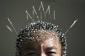 Hair loss in women and treatment with acupuncture. Hairguard On Twitter Acupuncture For Hair Loss Can It Work Https T Co Amutiewxlk