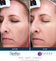 Find Best Skin Care Near Me In Sussex, NJ