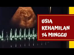 Lanjut tentang artikel aborsi cara menggugurkan kandungan secara medis untuk negara. Pertumbuhan Janin Usia 3 Bulan 14 Minggu Detak Jantung Terdengar Youtube